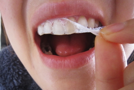 Crest3d Whiteの効果と口コミ ビフォーアフター画像を見る 自宅で簡単 3d Crestで歯をホワイトニングする方法